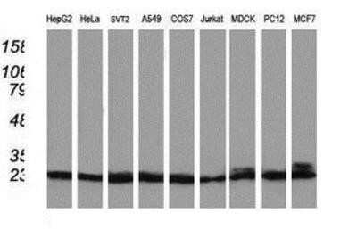 Western Blot: PNMT Antibody (OTI1D2)Azide and BSA Free [NBP2-73494]