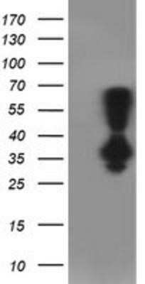 Western Blot: PNMT Antibody (OTI1D2)Azide and BSA Free [NBP2-73494]