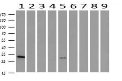 Western Blot: PNMT Antibody (OTI1D2) [NBP2-00688]