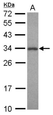 Western Blot: PNMT Antibody [NBP2-19877]