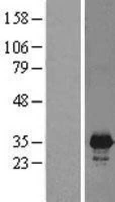 Western Blot: PNMT Overexpression Lysate [NBL1-14550]