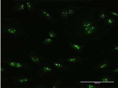 Immunocytochemistry/ Immunofluorescence: PNO1 Antibody [H00056902-B01P]