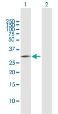 Western Blot: PNO1 Antibody [H00056902-B01P]