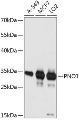 Western Blot: PNO1 AntibodyAzide and BSA Free [NBP2-94387]