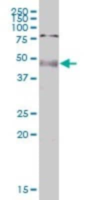 Western Blot: PNPLA1 Antibody [H00285848-B01P]