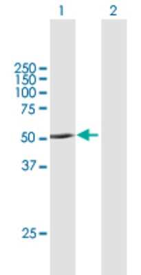 Western Blot: PNPLA1 Antibody [H00285848-B01P]