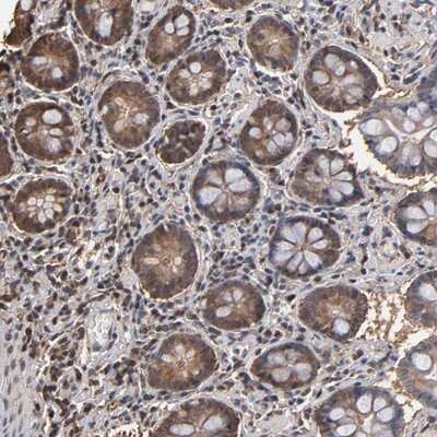 Immunohistochemistry-Paraffin: PNPLA4 Antibody [NBP1-84958]