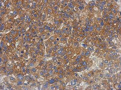 Immunohistochemistry-Paraffin: PNPLA4 Antibody [NBP2-19878]