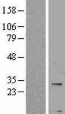 Western Blot: PNPLA4 Overexpression Lysate [NBP2-09636]