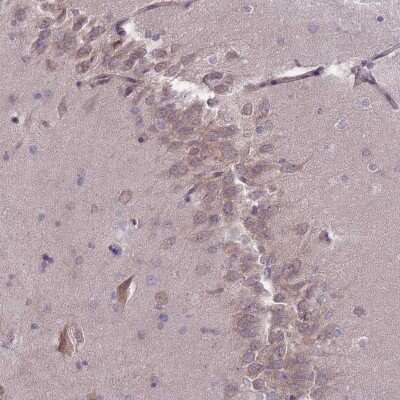 Immunohistochemistry: PNPLA5 Antibody [NBP2-48961]