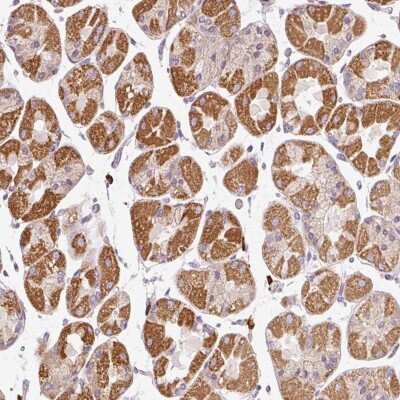 Immunohistochemistry: PNPLA5 Antibody [NBP2-49122]