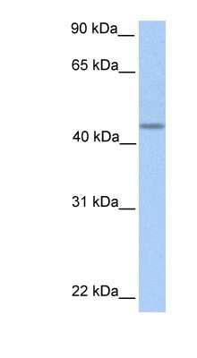 Western Blot: PNPLA5 Antibody [NBP1-70680]