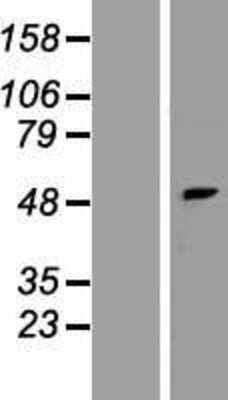 Western Blot: PNPLA5 Overexpression Lysate [NBP2-05628]