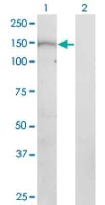 Western Blot: PNPLA6 Antibody (3D10) [H00010908-M08]