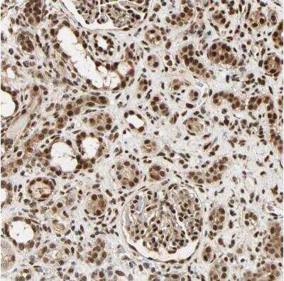 Immunohistochemistry-Paraffin: PNPLA6 Antibody [NBP1-80984]