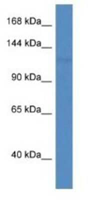 Western Blot: PNPLA6 Antibody [NBP1-74214]