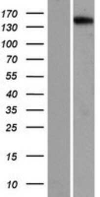 Western Blot: PNPLA6 Overexpression Lysate [NBP2-10163]