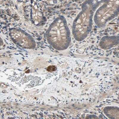 Immunohistochemistry-Paraffin: PNPLA7 Antibody [NBP1-91231]