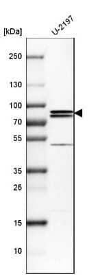 Western Blot: PNPLA8 Antibody [NBP1-83098]