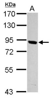 Western Blot: PNPLA8 Antibody [NBP2-19879]