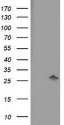 Western Blot: PNPO Antibody (OTI1H9) [NBP2-01088]