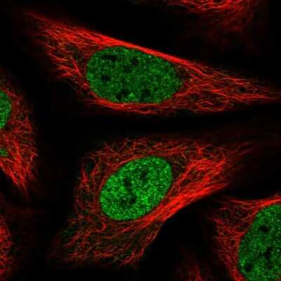 Immunocytochemistry/ Immunofluorescence: PNPO Antibody [NBP1-87302]