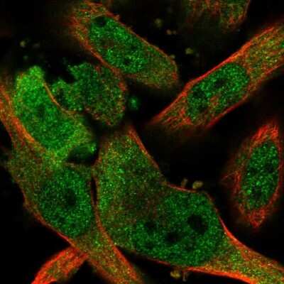 Immunocytochemistry/ Immunofluorescence: PNPO Antibody [NBP1-87303]