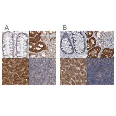Immunohistochemistry-Paraffin: PNPO Antibody [NBP1-87302]