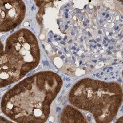 Immunohistochemistry-Paraffin: PNPO Antibody [NBP1-87303]
