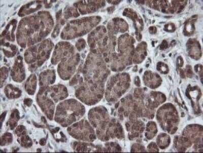 Immunohistochemistry: PNPO Antibody (OTI1G9) [NBP2-45361]