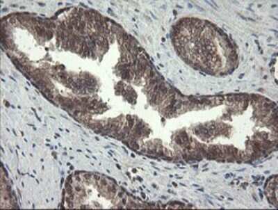 Immunohistochemistry: PNPO Antibody (OTI1G9) [NBP2-45361]