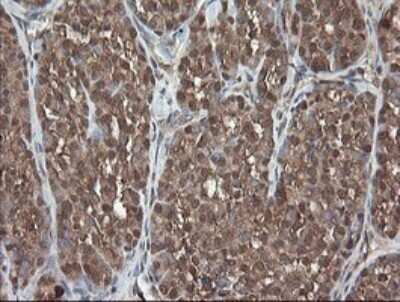 Immunohistochemistry: PNPO Antibody (OTI1G9) [NBP2-45361]