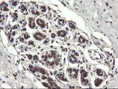 Immunohistochemistry: PNPO Antibody (OTI1G9) [NBP2-45361]