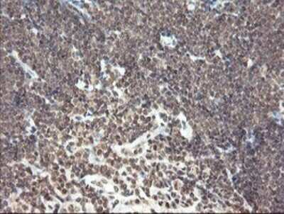 Immunohistochemistry: PNPO Antibody (OTI1G9) [NBP2-45361]