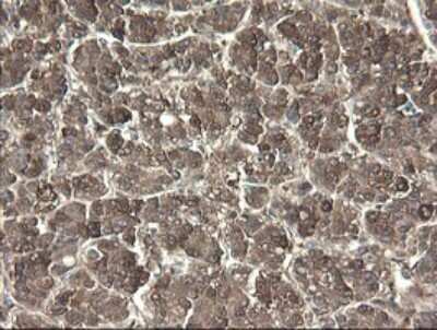 Immunohistochemistry: PNPO Antibody (OTI1G9) [NBP2-45361]