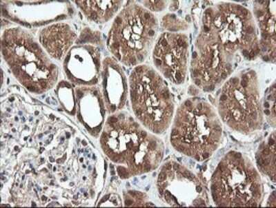 Immunohistochemistry: PNPO Antibody (OTI1G9) [NBP2-45361]