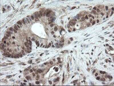 Immunohistochemistry: PNPO Antibody (OTI1G9) [NBP2-45361]