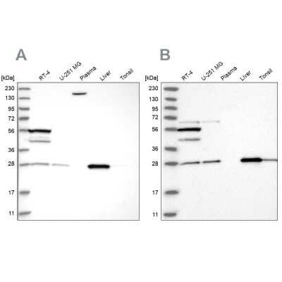 Western Blot: PNPO Antibody [NBP1-87303]