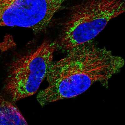 Immunocytochemistry/ Immunofluorescence: PNPT1 Antibody [NBP1-82485]