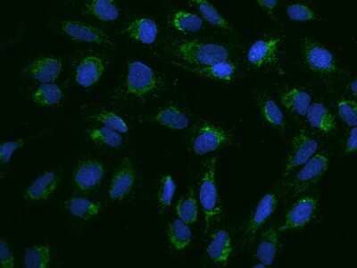 Immunocytochemistry/ Immunofluorescence: PNPT1 Antibody [NBP2-97714]