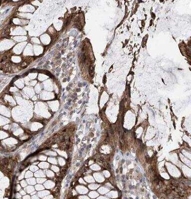 Immunohistochemistry-Paraffin: PNPT1 Antibody [NBP1-82485]