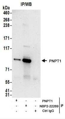Immunoprecipitation: PNPT1 Antibody [NBP2-22269]