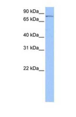 Western Blot: PNPT1 Antibody [NBP1-57179]