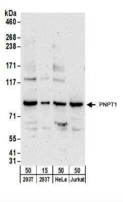 Western Blot: PNPT1 Antibody [NBP2-22269]