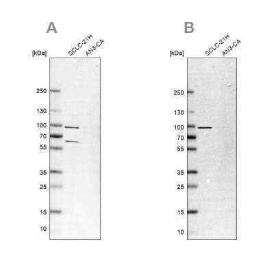 Western Blot: PNPT1 Antibody [NBP2-38211]