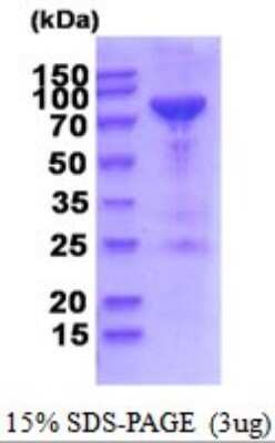 SDS-PAGE: Recombinant Human PNPT1 His Protein [NBP2-52027]