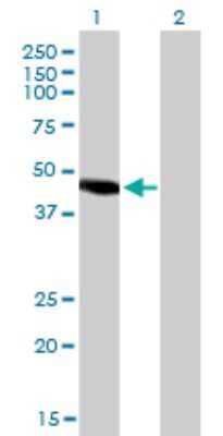 Western Blot: PNR/NR2E3 Antibody (2A12) [H00010002-M01]