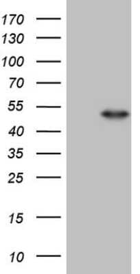 Western Blot: PNR/NR2E3 Antibody (OTI3D4) [NBP2-46235]