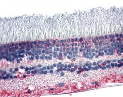 Immunohistochemistry-Paraffin: PNR/NR2E3 Antibody - BSA Free [NLS5769]