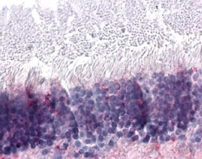 Immunohistochemistry-Paraffin: PNR/NR2E3 Antibody - BSA Free [NLS5770]